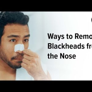 Ways to Remove Blackheads From the Nose | Healthline